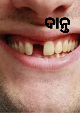 ଦାନ୍ତ
