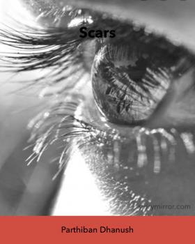 Scars