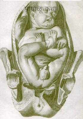 पायाळू-कथा