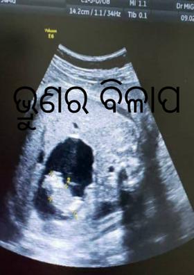 ଭ୍ରୁଣର ବିଳାପ