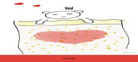Void