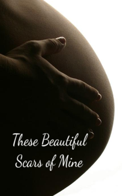 These Beautiful Scars Of Mine