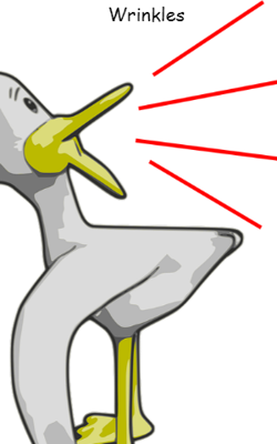 Wrinkles
