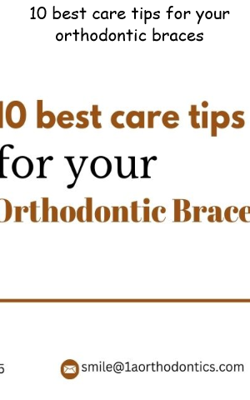 10 best care tips for your orthodontic braces