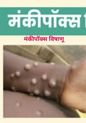 मंकीपॉक्स विषाणू