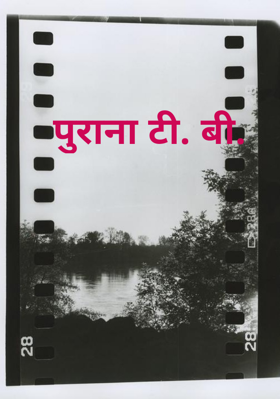 पुराना टी. बी.