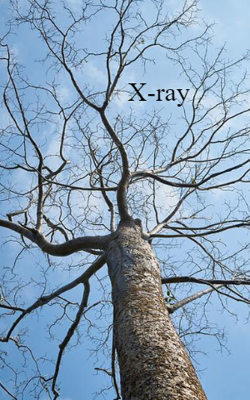 X-ray