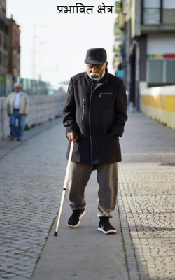 प्रभावित क्षेत्र