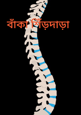 বাঁকা শিঁড়দাড়া 