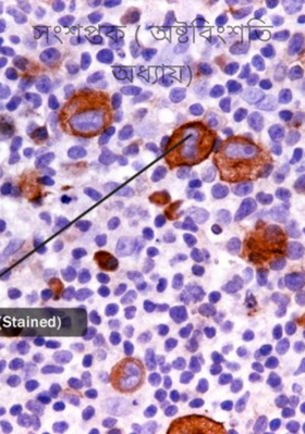 সংশপ্তক ( অষ্টবিংশতি অধ্যায়)