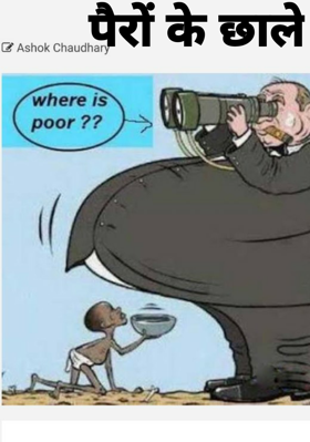 पैरों के छाले