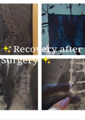 ✨Recovery after Surgery ✨