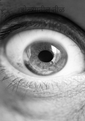 डोळ्यातील तीळ