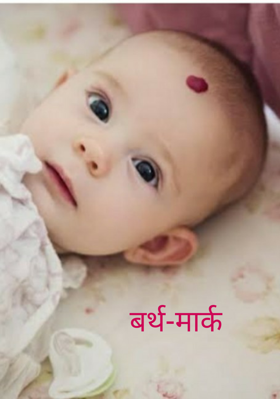 बर्थ-मार्क