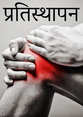 प्रतिस्थापन