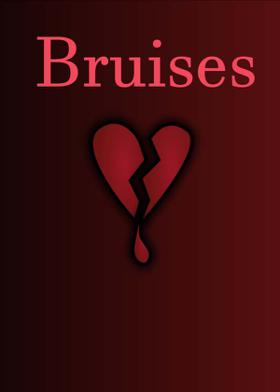 Bruises